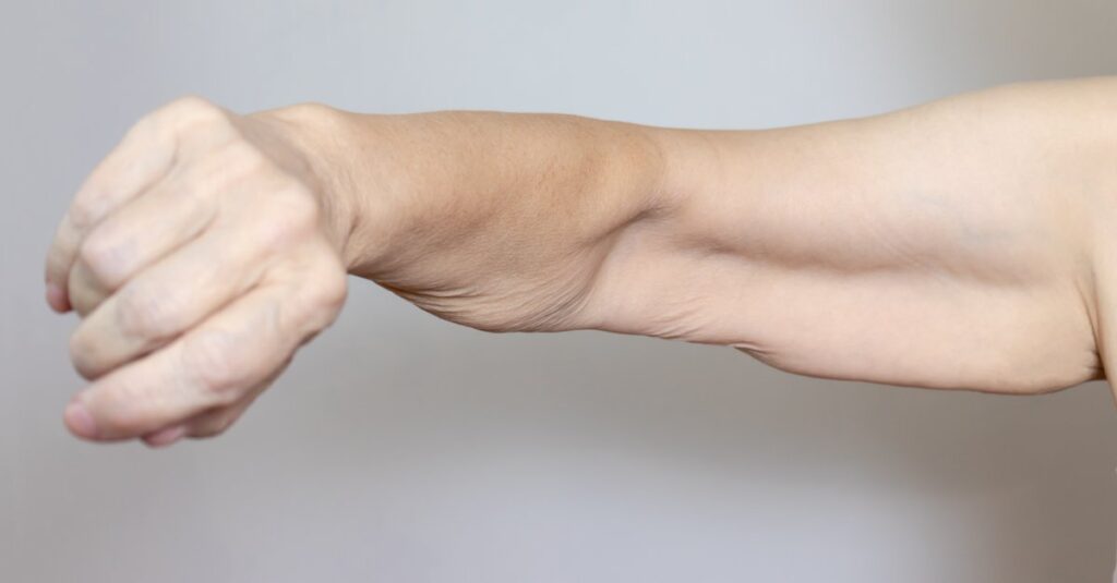 Close-up of a midlife woman's extended arm showing softer muscle tone, representing muscle loss after menopause
