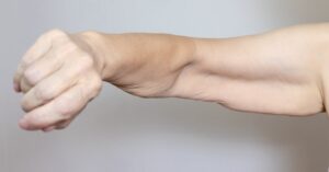 Close-up of a midlife woman's extended arm showing softer muscle tone, representing muscle loss after menopause